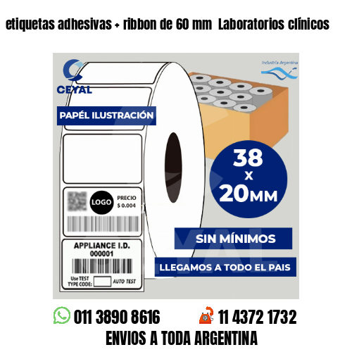 etiquetas adhesivas   ribbon de 60 mm  Laboratorios clínicos