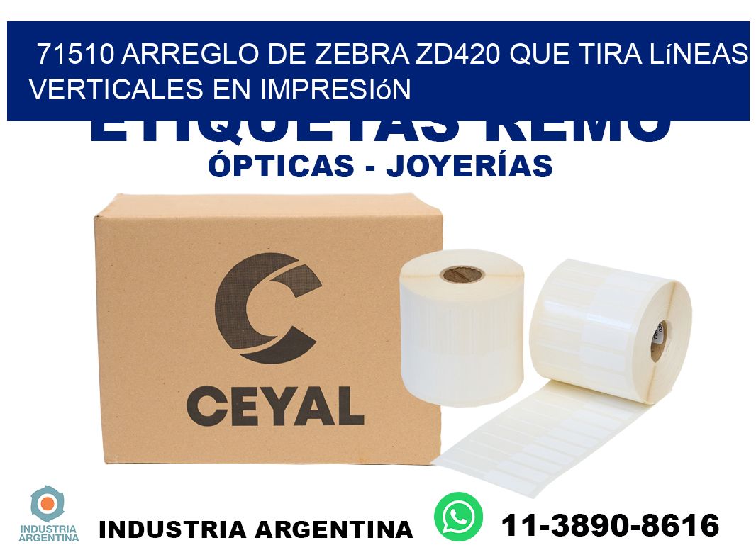 71510 arreglo de zebra zd420 que tira líneas verticales en impresión